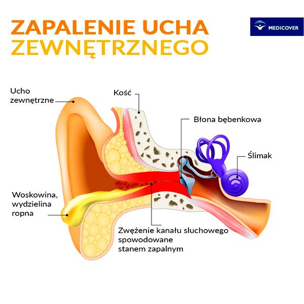 Zapalenie ucha u dziecka